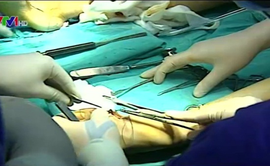 Áp dụng kỹ thuật tiên tiến phẫu thuật dị tật xương bàn chân