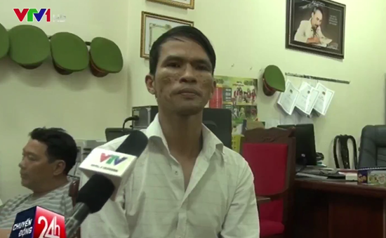 30 giờ vây bắt đối tượng hành hạ bé trai Campuchia