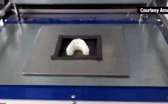 Tự chế niềng răng bằng máy in 3D
