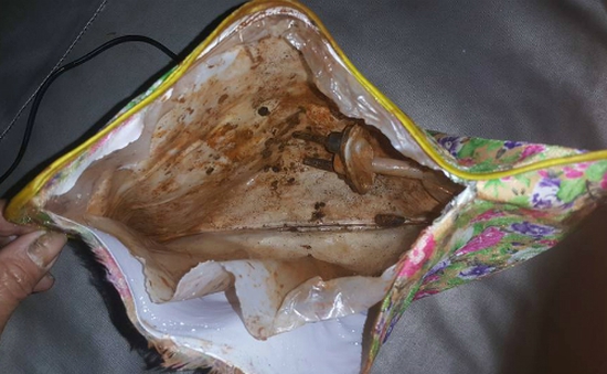 Nghệ An: Túi chườm phát nổ khi đang sạc