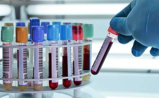 Ứng dụng kỹ thuật phân tử trong xét nghiệm máu sàng lọc virus