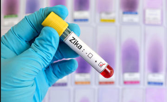 200 mẫu bệnh phẩm âm tính với virus Zika