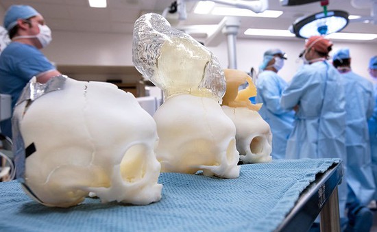 Mô hình 3D giúp phẫu thuật thực hành não