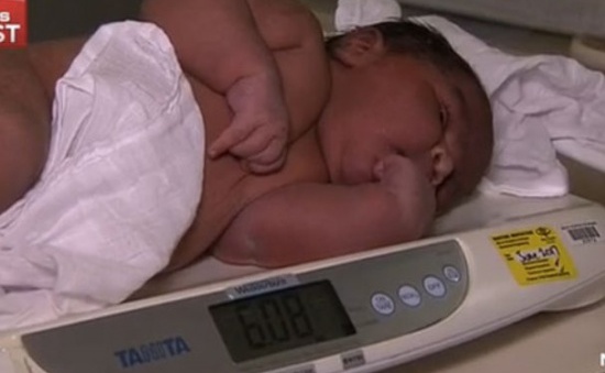 Australia chào đón em bé nặng ký nhất thế giới