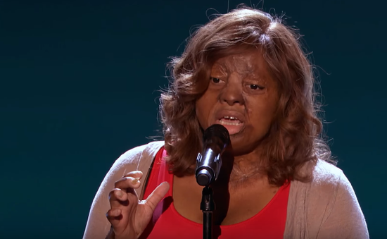 America's Got Talent: Xúc động trước giọng ca của cô gái sống sót sau tai nạn máy bay