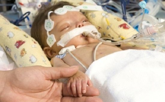 Bệnh tim bẩm sinh ở trẻ sơ sinh - Nguyên nhân và hướng điều trị