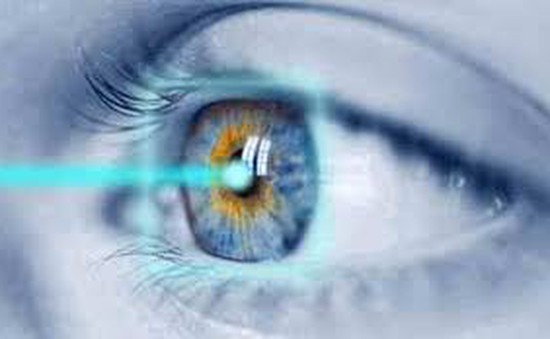 Phẫu thuật mắt cận thị Laser - Lasik