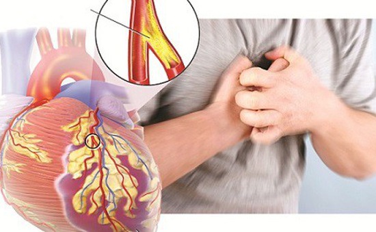 Thuốc lá là nguyên nhân chính của bệnh tim mạch