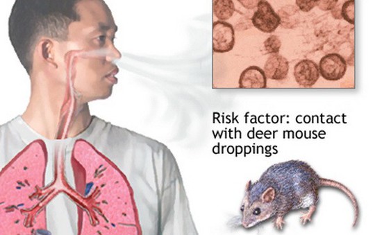 Argentina đối phó dịch virus lây từ chuột sang người