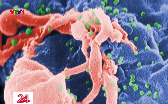 Thêm một bệnh nhân loại bỏ được virus HIV/AIDS khỏi cơ thể
