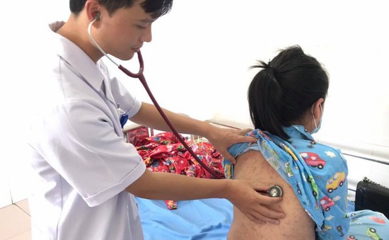 Cảnh báo: Bệnh sởi có chiều hướng gia tăng tại Quảng Ninh