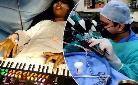 Cô bé Ấn Độ chơi đàn trong khi đang phẫu thuật não