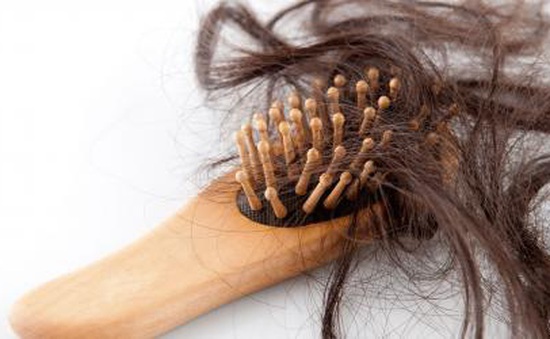 Lý do người bệnh ung thư bị rụng tóc trong quá trình hóa trị