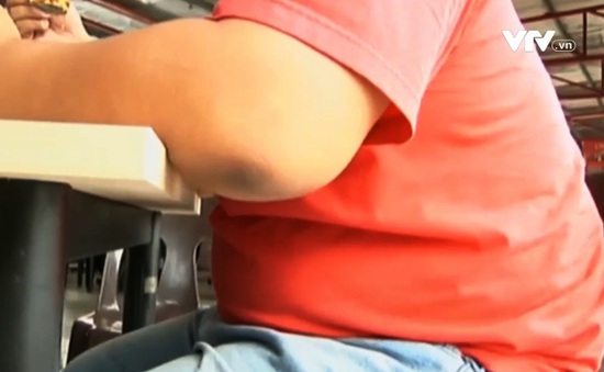 Một nửa số người trưởng thành tại Malaysia mắc bệnh béo phì