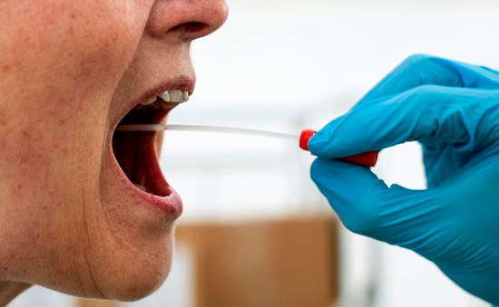 Phát hiện thêm triệu chứng lạ ở lưỡi của bệnh nhân COVID-19