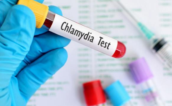 Phòng bệnh lây truyền qua đường tình dục Chlamydia