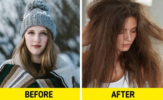 Mẹo hiệu quả khắc phục tóc khô, chẻ ngọn, gãy rụng vào mùa đông