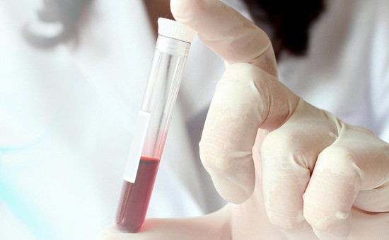 Phương pháp chẩn đoán nhiều bệnh từ xét nghiệm máu