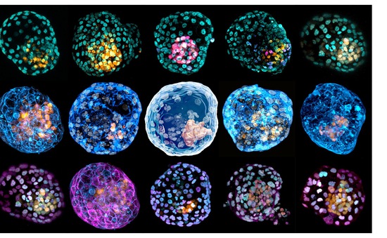Công bố mô hình bào thai người đầu tiên được tạo nên từ tế bào da