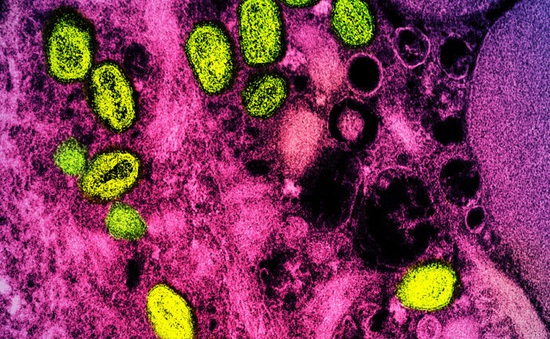 Bệnh đậu mùa khỉ được đổi tên thành "mpox"