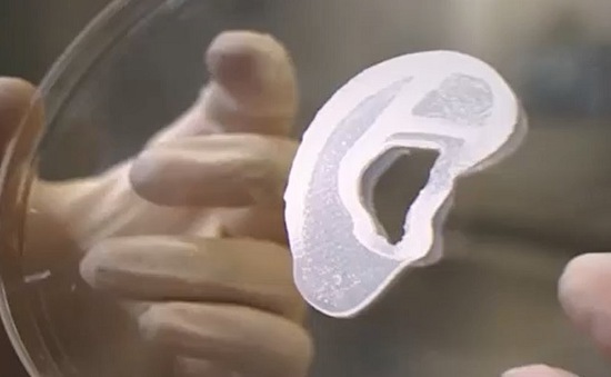 Mỹ lần đầu tiên cấy ghép thành công tai người in 3D