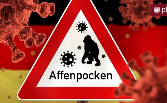 Châu Âu không lo lắng thái quá, bình tĩnh đối phó với dịch đậu mùa khỉ