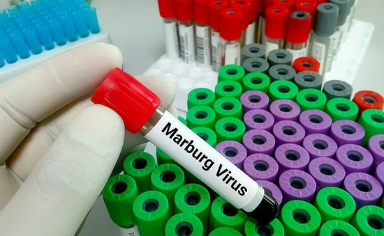Bùng phát virus Marburg gây tử vong cao ở Tanzania