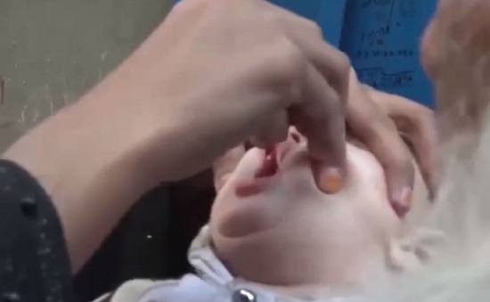 Phạt tù phụ huynh không cho con dùng vaccine phòng bại liệt