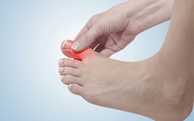 Đau ngón chân cái có thể liên quan đến các vấn đề sức khỏe khác không?

