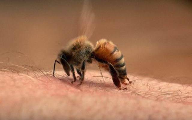 Nếu bị ong đốt, nên bôi chất gì để làm dịu đau và giảm sưng?
