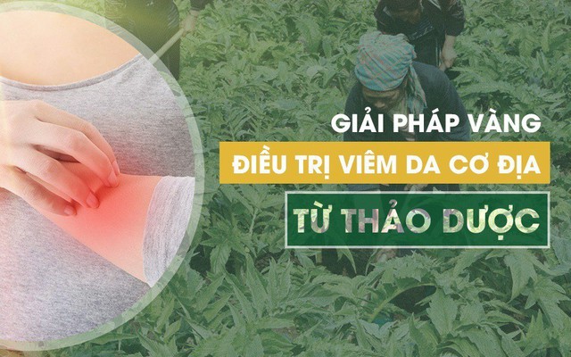 Viêm da cơ địa có phổ biến trong xã hội không?
