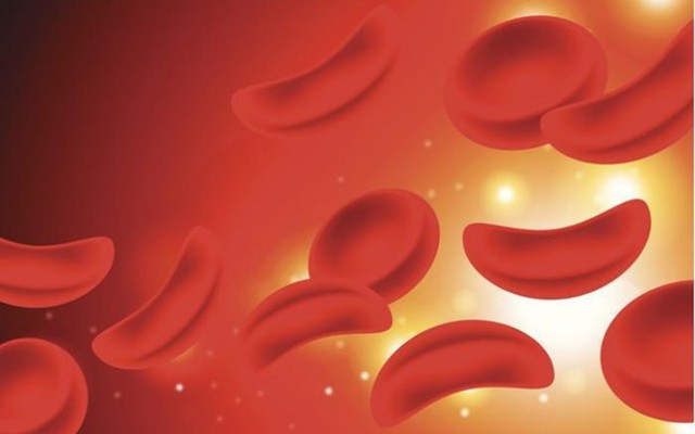 Những nguyên tắc sinh hoạt hàng ngày nào cần tuân thủ để giảm nguy cơ mắc bệnh hồng cầu hình liềm?