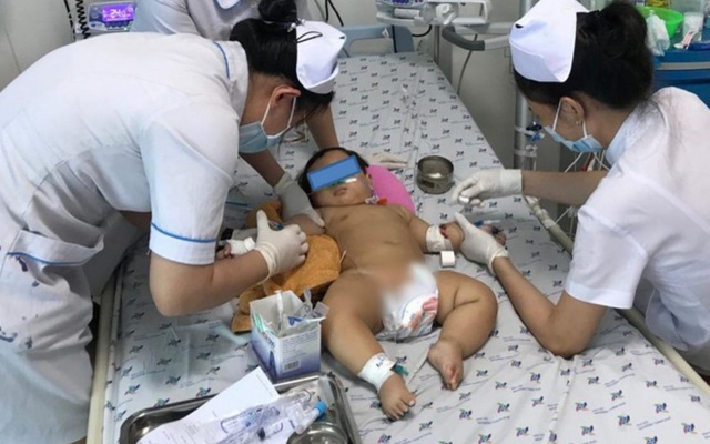 Bệnh quai bị có vaccine phòng ngừa không? Nếu có, nó được khuyến cáo dùng trong trường hợp nào?
