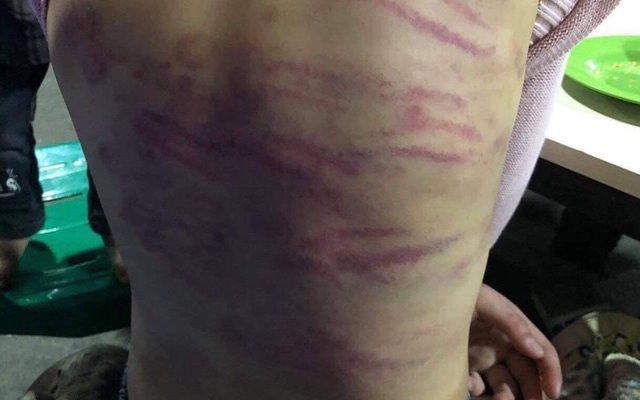 Bé gái 12 tuổi ở Hà Nội bị mẹ đẻ và người tình đánh đập dã man | VTV.VN