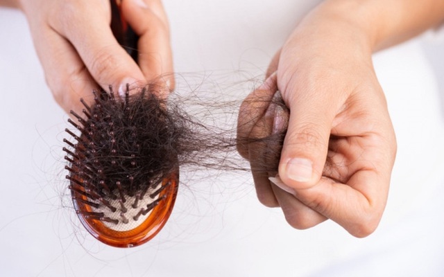 Tóc rụng nhiều ở nam: Nguyên nhân và cách chữa trị hiệu quả nhất