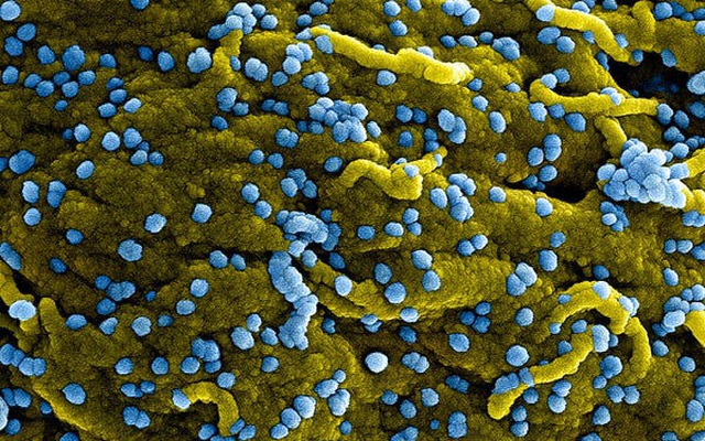 Cách phòng chống và điều trị bệnh do virus Marburg? 
