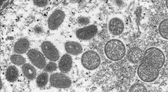 Vietnam announces first case of monkeypox