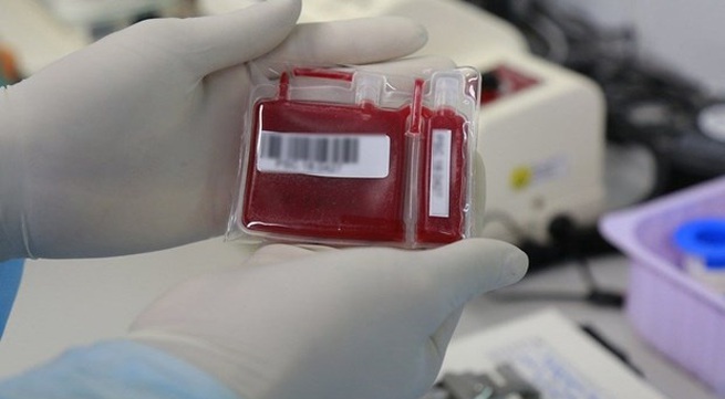 National hematology institute expands stem cell collection services
