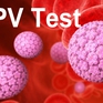Bộ dụng cụ tự sàng lọc giúp phụ nữ Thái Lan tự xét nghiệm HPV